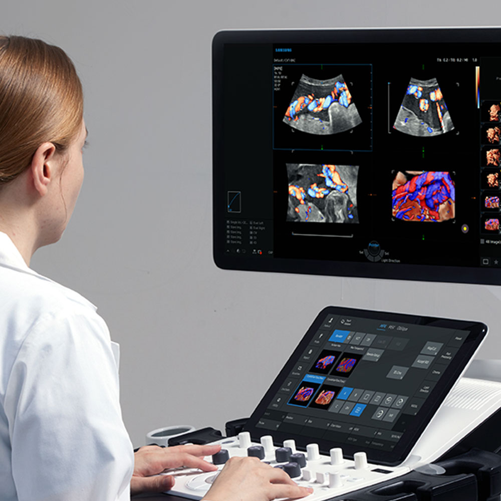 Ultrasonido Samsung V6 - Image 2