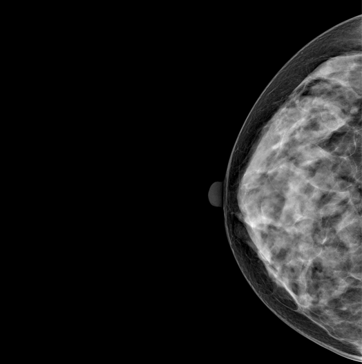 Genoray DMX-600 - Image 2