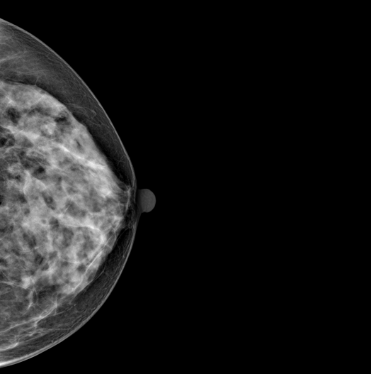 Genoray DMX-600 - Image 3