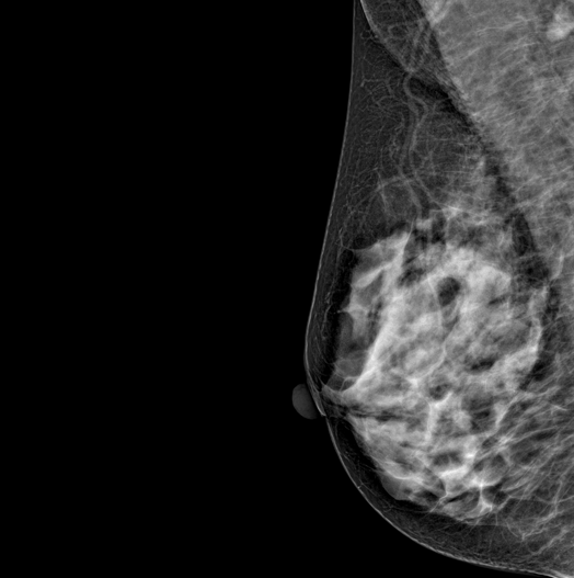 Genoray DMX-600 - Image 4