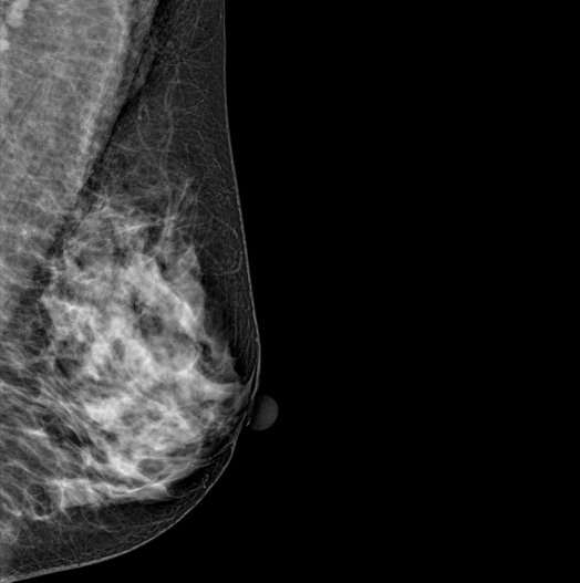 Genoray DMX-600 - Image 5