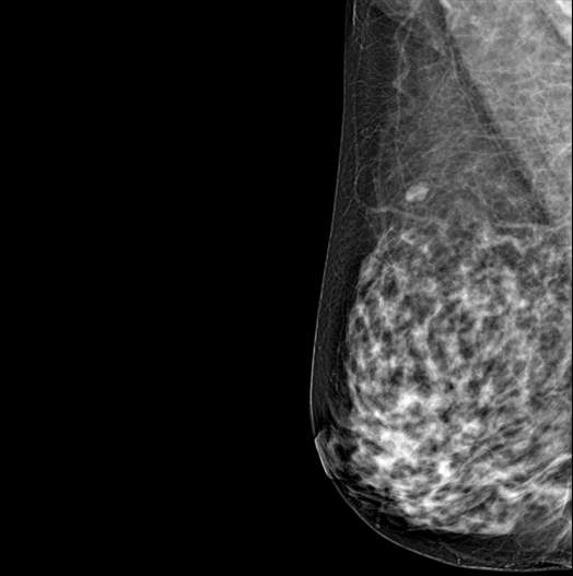 Genoray DMX-600 - Image 6