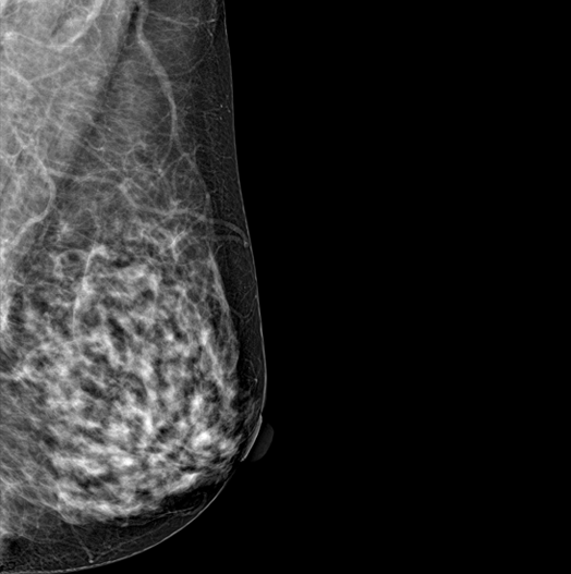 Genoray DMX-600 - Image 7