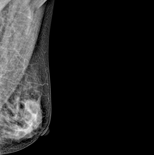 Genoray DMX-600 - Image 9