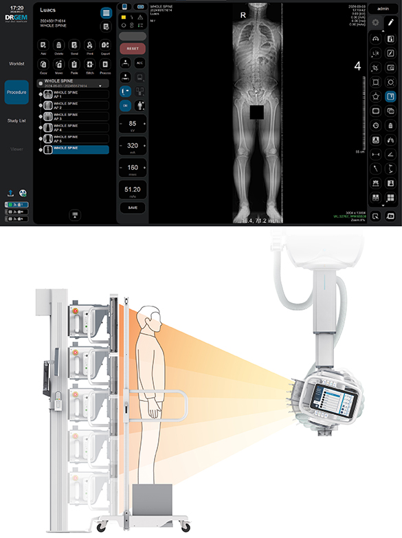 Rayos X de Techo - Image 7