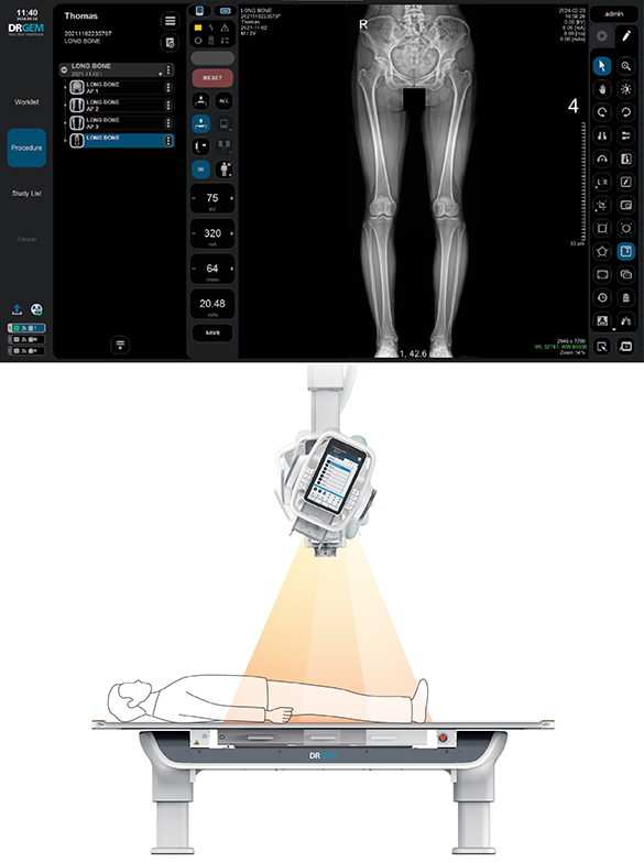Rayos X de Techo - Image 8